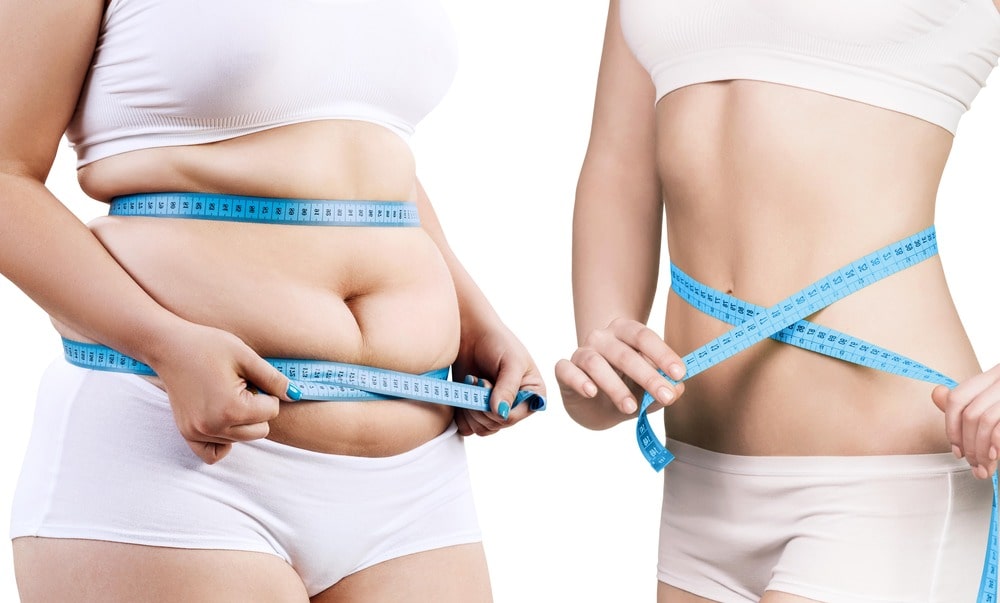 Gastric Sleeve Surgery - Is it a Smart Health Investment for Long-Term Wellness?